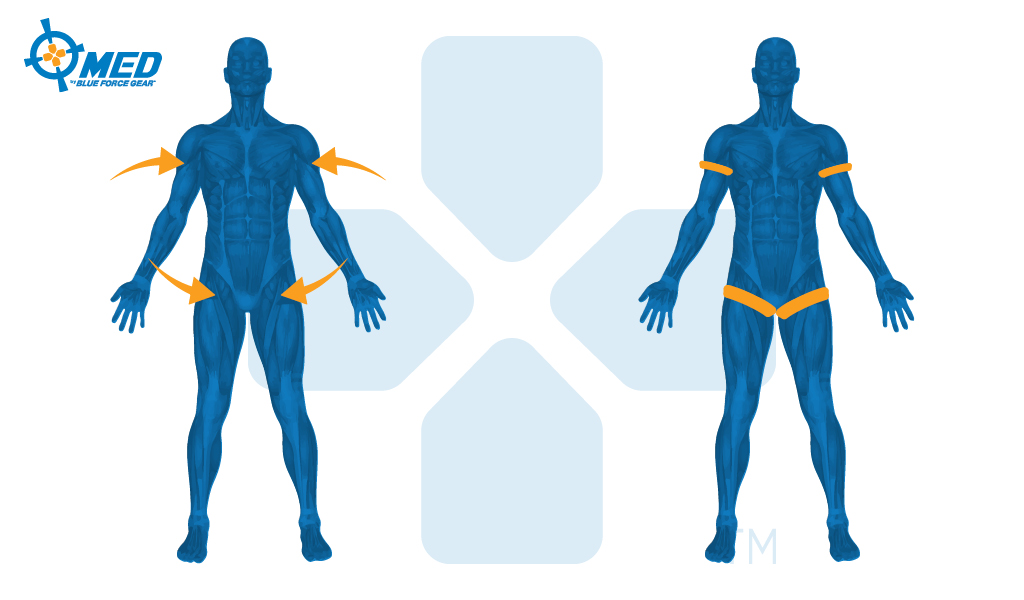 Four Tourniquet Placement Locations on the Body