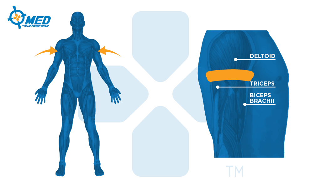 Tourniquet Placement on Arm diagram - Top Bicep and tricep