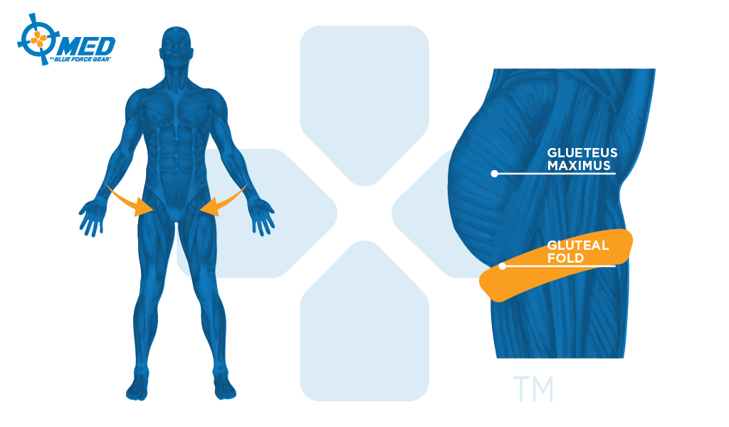 Tourniquet Placement on Leg diagram